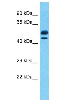 EBF2 Antibody - EBF2 antibody Western Blot of Thymus Tumor. Antibody dilution: 1 ug/ml.  This image was taken for the unconjugated form of this product. Other forms have not been tested.