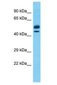 EBF2 Antibody - EBF2 antibody Western Blot of Thymus Tumor. Antibody dilution: 1 ug/ml.  This image was taken for the unconjugated form of this product. Other forms have not been tested.