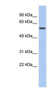 EBF2 Antibody - EBF2 antibody Western blot of ACHN lysate. This image was taken for the unconjugated form of this product. Other forms have not been tested.