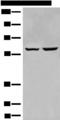 EBF2 Antibody - Western blot analysis of HEPG2 and Jurkat cell lysates  using EBF2 Polyclonal Antibody at dilution of 1:650