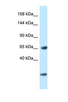 EBF3 / COE3 Antibody - EBF3 antibody Western blot of Rat Lung lysate. Antibody concentration 1 ug/ml.  This image was taken for the unconjugated form of this product. Other forms have not been tested.