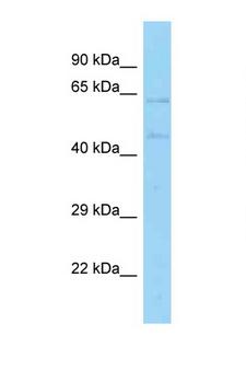 EBF4 Antibody - EBF4 antibody Western blot of HT1080 Cell lysate. Antibody concentration 1 ug/ml.  This image was taken for the unconjugated form of this product. Other forms have not been tested.