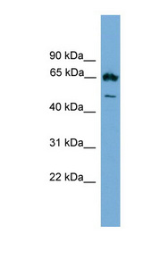 EBF4 Antibody - EBF4 antibody Western blot of SP2/0 cell lysate. This image was taken for the unconjugated form of this product. Other forms have not been tested.
