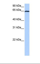 EBF4 Antibody - Jurkat cell lysate. Antibody concentration: 0.5 ug/ml. Gel concentration: 12%.  This image was taken for the unconjugated form of this product. Other forms have not been tested.