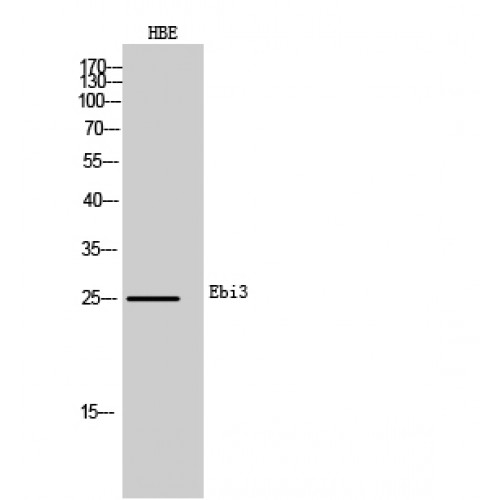 EBI3 / IL-27B Antibody - Western blot of Ebi3 antibody