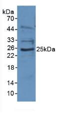 EBI3 / IL-27B Antibody