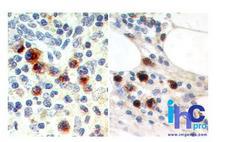 EBI3 / IL-27B Antibody - Immunohistochemistry-Paraffin: IL-27/IL-35 EBI3 Subunit Antibody (15k8D10) - Formalin-fixed, paraffin-embedded human spleen (left) and lymph node metastatic malignant melanoma (right) stained with IL-35 antibody (5 ug/ml) using peroxidase-conjugate and DAB chromogen.