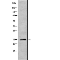 EBI3 / IL-27B Antibody - Western blot analysis of EBI3 using COLO205 whole cells lysates