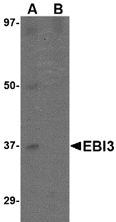 EBI3 / IL-27B Antibody - Western blot of EBI3 in K562 lysate with EBI3 antibody at 1 ug/ml in (A) the absence and (B) the presence of blocking peptide.