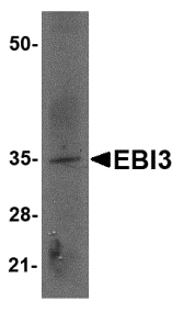 EBI3 / IL-27B Antibody - Western blot of EBI3 in rat spleen tissue lysate with EBI3 antibody at 2 ug/ml.
