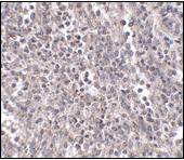 EBI3 / IL-27B Antibody - Immunohistochemistry of EBI3 in human spleen tissue with EBI3 Antibody at 2.5 ?/ml.