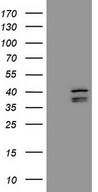 EBLN2 / FLJ10213 Antibody - HEK293T cells were transfected with the pCMV6-ENTRY control. (Left lane) or pCMV6-ENTRY EBLN2. (Right lane) cDNA for 48 hrs and lysed. Equivalent amounts of cell lysates. (5 ug per lane) were separated by SDS-PAGE and immunoblotted with anti-EBLN2. (1:500)