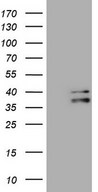 EBLN2 / FLJ10213 Antibody - HEK293T cells were transfected with the pCMV6-ENTRY control. (Left lane) or pCMV6-ENTRY EBLN2. (Right lane) cDNA for 48 hrs and lysed
