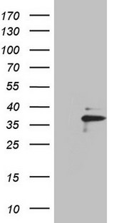 EBLN2 / FLJ10213 Antibody - HEK293T cells were transfected with the pCMV6-ENTRY control. (Left lane) or pCMV6-ENTRY EBLN2. (Right lane) cDNA for 48 hrs and lysed. Equivalent amounts of cell lysates. (5 ug per lane) were separated by SDS-PAGE and immunoblotted with anti-EBLN2. (1:2000)