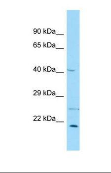 EBNA1BP2 Antibody - Western blot of COLO205. ENGASE antibody dilution 1.0 ug/ml.  This image was taken for the unconjugated form of this product. Other forms have not been tested.