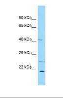 EBNA1BP2 Antibody - Western blot of COLO205. ENGASE antibody dilution 1.0 ug/ml.  This image was taken for the unconjugated form of this product. Other forms have not been tested.