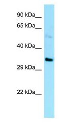 EBNA1BP2 Antibody - EBNA1BP2 antibody Western Blot of HepG2.  This image was taken for the unconjugated form of this product. Other forms have not been tested.