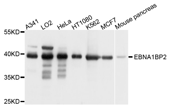EBNA1BP2 Antibody - Western blot analysis of extract of various cells.