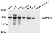 EBNA1BP2 Antibody - Western blot analysis of extract of various cells.