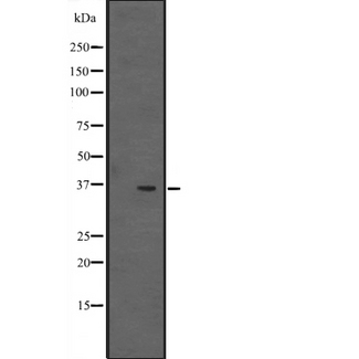EBNA1BP2 Antibody - Western blot analysis of EBP2 expression in NCI-H292 cells line lysates. The lane on the left is treated with the antigen-specific peptide.