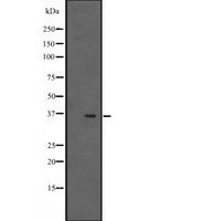 EBNA1BP2 Antibody - Western blot analysis of EBP2 expression in NCI-H292 cells line lysates. The lane on the left is treated with the antigen-specific peptide.