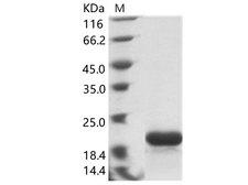 NucleoProtein Protein - Recombinant EBOV (subtype Zaire, strain H.sapiens-wt/GIN/2014/Kissidougou-C15) Nucleoprotein / NP Protein (His Tag)