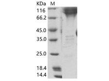Zaire Ebolavirus Glycoprotein GP2 Protein - Recombinant EBOV (subtype Zaire, strain H.sapiens-wt/GIN/2014/Kissidougou-C15) GP2 / Glycoprotein Protein (Fc Tag)