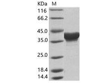 Zaire Ebolavirus Matrix Protein VP40 Protein - Recombinant EBOV (subtype Zaire, strain H.sapiens-wt/GIN/2014/Kissidougou-C15) Matrix protein VP40 Protein (His Tag)