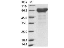 Zaire Ebolavirus Matrix Protein VP40 Protein - Recombinant EBOV (subtype Zaire, strain H.sapiens-wt/GIN/2014/Kissidougou-C15) VP40 / Matrix protein VP40 Protein (His & MBP Tag)