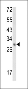 EBP Antibody - Western blot of EBP Antibody in mouse kidney tissue lysates (35 ug/lane). EBP (arrow) was detected using the purified antibody.