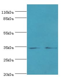 EBP Antibody - Western blot. All lanes: EBP antibody at 2 ug/ml Lane 1:A549 whole cell lysate. Lane 2: 293T whole cell lysate. Secondary antibody: Goat polyclonal to rabbit at 1:10000 dilution. Predicted band size: 35 kDa. Observed band size: 35 kDa.  This image was taken for the unconjugated form of this product. Other forms have not been tested.