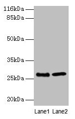 EBP Antibody - Western blot All lanes: EBP antibody at 2µg/ml Lane 1: A549 whole cell lysate Lane 2: 293T whole cell lysate Secondary Goat polyclonal to rabbit IgG at 1/10000 dilution Predicted band size: 35 kDa Observed band size: 35 kDa