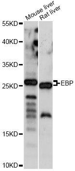 EBP Antibody - Western blot analysis of extracts of various cell lines, using EBP antibody at 1:1000 dilution. The secondary antibody used was an HRP Goat Anti-Rabbit IgG (H+L) at 1:10000 dilution. Lysates were loaded 25ug per lane and 3% nonfat dry milk in TBST was used for blocking. An ECL Kit was used for detection and the exposure time was 5s.