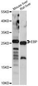 EBP Antibody - Western blot analysis of extracts of various cell lines, using EBP antibody at 1:1000 dilution. The secondary antibody used was an HRP Goat Anti-Rabbit IgG (H+L) at 1:10000 dilution. Lysates were loaded 25ug per lane and 3% nonfat dry milk in TBST was used for blocking. An ECL Kit was used for detection and the exposure time was 5s.