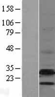 EBP Protein - Western validation with an anti-DDK antibody * L: Control HEK293 lysate R: Over-expression lysate