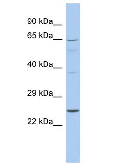 EBS / NAT9 Antibody - EBS / NAT9 antibody Western Blot of Fetal Spleen. Antibody dilution: 1 ug/ml.  This image was taken for the unconjugated form of this product. Other forms have not been tested.