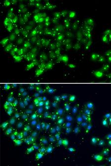 EBS / NAT9 Antibody - Immunofluorescence analysis of MCF-7 cells using NAT9 Polyclonal Antibody.