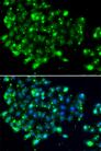 EBS / NAT9 Antibody - Immunofluorescence analysis of MCF-7 cells using NAT9 Polyclonal Antibody.