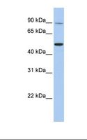 ECaC / TRPV5 Antibody - 721_B cell lysate. Antibody concentration: 1.0 ug/ml. Gel concentration: 12%.  This image was taken for the unconjugated form of this product. Other forms have not been tested.