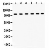 ECaC / TRPV5 Antibody - TRPV5 antibody Western blot. All lanes: Anti TRPV5 at 0.5 ug/ml. Lane 1: Rat Pancreas Tissue Lysate at 50 ug. Lane 2: Rat Lung Tissue Lysate at 50 ug. Lane 3: Rat Intestine Tissue Lysate at 50 ug. Lane 4: SW620 Whole Cell Lysate at 40 ug. Lane 5: COLO320 Whole Cell Lysate at 40 ug. Lane 6: 293T Whole Cell Lysate at 40 ug. Predicted band size: 83 kD. Observed band size: 83 kD.