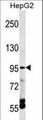 ECaC / TRPV5 Antibody - TRPV5 Antibody western blot of HepG2 cell line lysates (35 ug/lane). The TRPV5 antibody detected the TRPV5 protein (arrow).