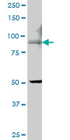 ECaC / TRPV5 Antibody - TRPV5 monoclonal antibody (M06), clone 6D6. Western blot of TRPV5 expression in IMR-32.