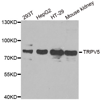 ECaC / TRPV5 Antibody - Western blot analysis of extracts of various cell lines.