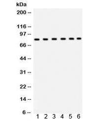 ECaC / TRPV5 Antibody