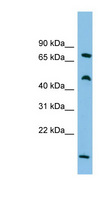 ECD Antibody - ECD antibody Western blot of ACHN lysate. This image was taken for the unconjugated form of this product. Other forms have not been tested.