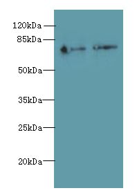 ECD Antibody - Western blot. All lanes: ECD antibody at 6 ug/ml. Lane 1: HeLa whole cell lysate. Lane 2: U251 whole cell lysate. Secondary antibody: Goat polyclonal to Rabbit IgG at 1:10000 dilution. Predicted band size: 73 kDa. Observed band size: 73 kDa.