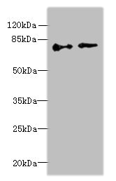 ECD Antibody - Western blot All lanes: ECD antibody at 6µg/ml Lane 1: Hela whole cell lysate Lane 2: U251 whole cell lysate Secondary Goat polyclonal to rabbit IgG at 1/10000 dilution Predicted band size: 73, 68, 77 kDa Observed band size: 73 kDa