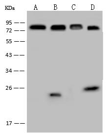 ECD Antibody - Anti-ECD rabbit polyclonal antibody at 1:500 dilution. Lane A: Jurkat Whole Cell Lysate. Lane B: HeLa Whole Cell Lysate. Lane C: 293T Whole Cell Lysate. Lane D: U-251MG Whole Cell Lysate. Lysates/proteins at 30 ug per lane. Secondary: Goat Anti-Rabbit IgG (H+L)/HRP at 1/10000 dilution. Developed using the ECL technique. Performed under reducing conditions. Predicted band size: 73 kDa.
