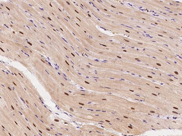 ECD Antibody - Immunochemical staining ECD in cynomolgus heart with rabbit polyclonal antibody at 1:300 dilution, formalin-fixed paraffin embedded sections.