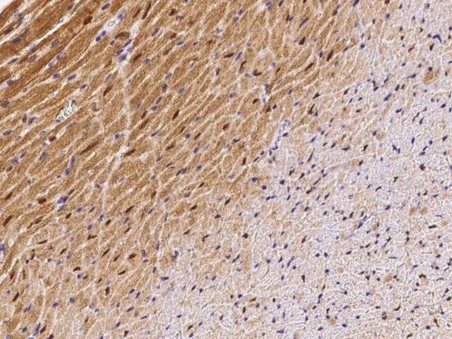 ECD Antibody - Immunochemical staining ECD in mouse heart with rabbit polyclonal antibody at 1:300 dilution, formalin-fixed paraffin embedded sections.
